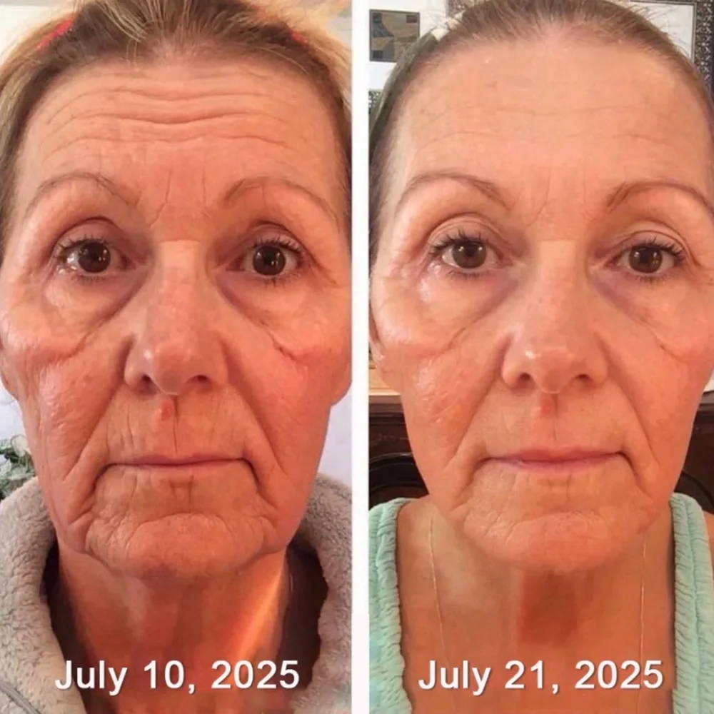 Botox & Retinol Shot Anti-Aging Cream